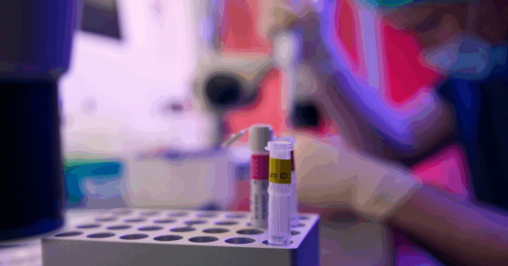 clinic lab integration – test tubes in a rack with a clinician pipetting in the background, representing standardized order entry and result delivery