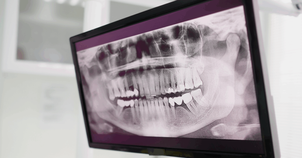 Dental panoramic X-ray on a clinical monitor – PACS integration in healthcare with viewer embedding and reliable DICOM routing.