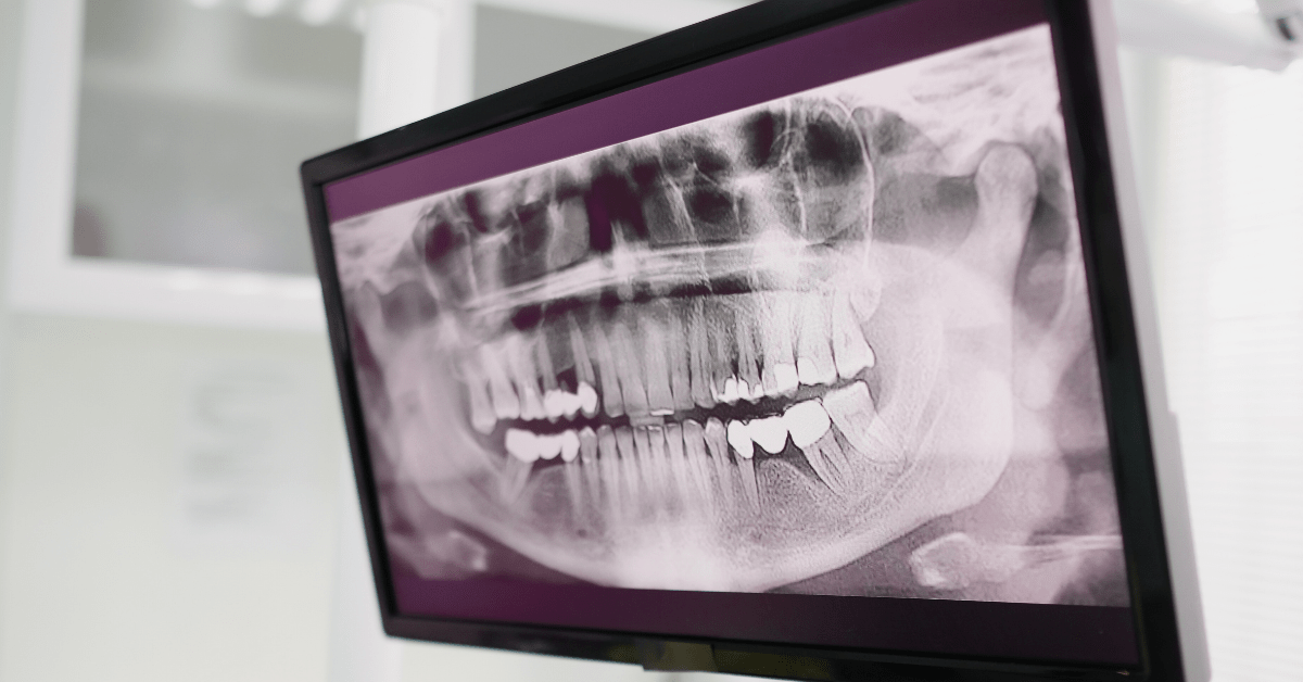 Dental panoramic X-ray on a clinical monitor – PACS integration in healthcare with viewer embedding and reliable DICOM routing.